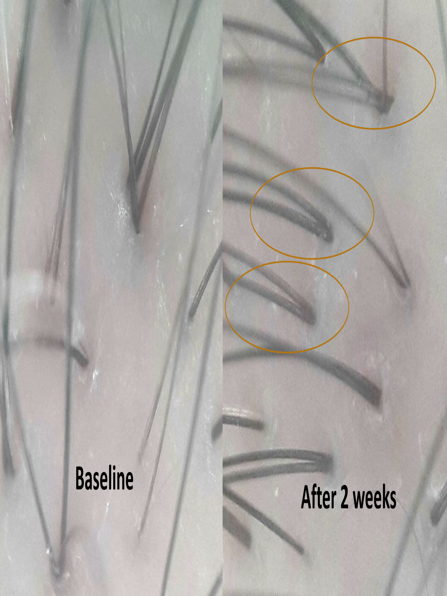 RHX APEX™ Advanced Follicle Activator - for a luxury skin aesthetic clinic