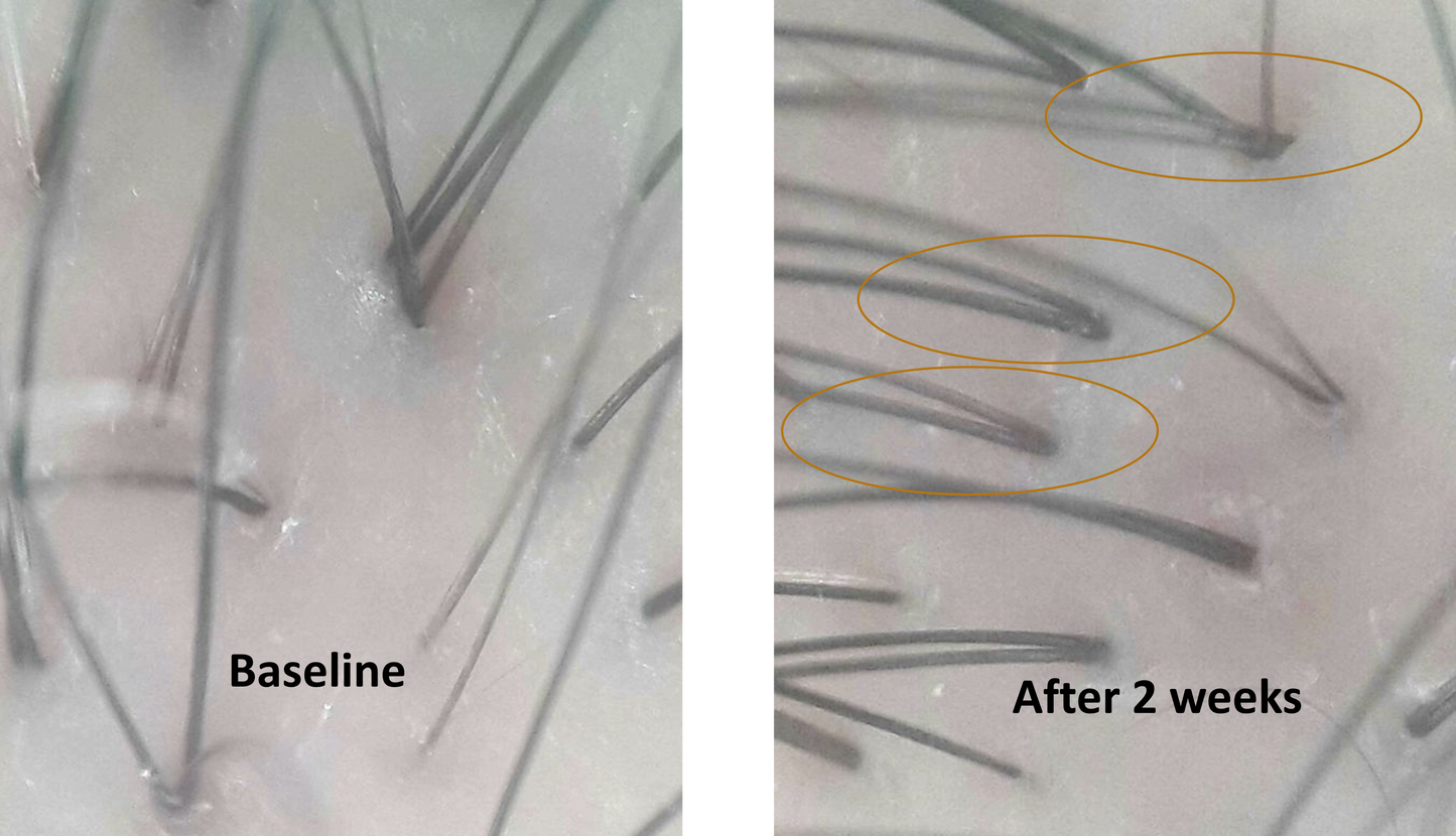 RHX APEX™ Advanced Follicle Activator