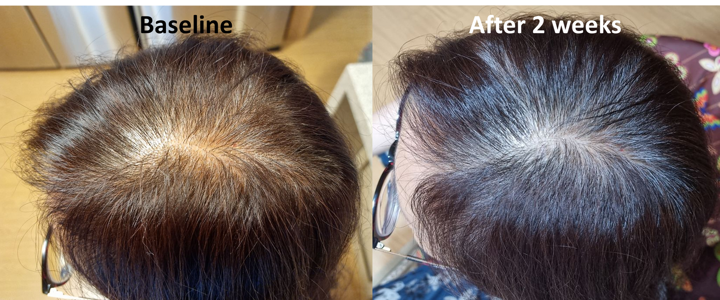 LIORA VERTEX™ Advanced Follicle Activator