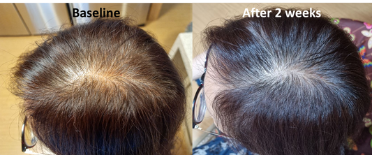 LIORA VERTEX™ Advanced Follicle Activator