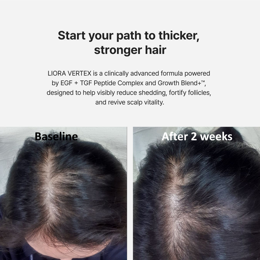 LIORA RÉVIA™ Advanced Follicle Activator - for a luxury skin aesthetic clinic