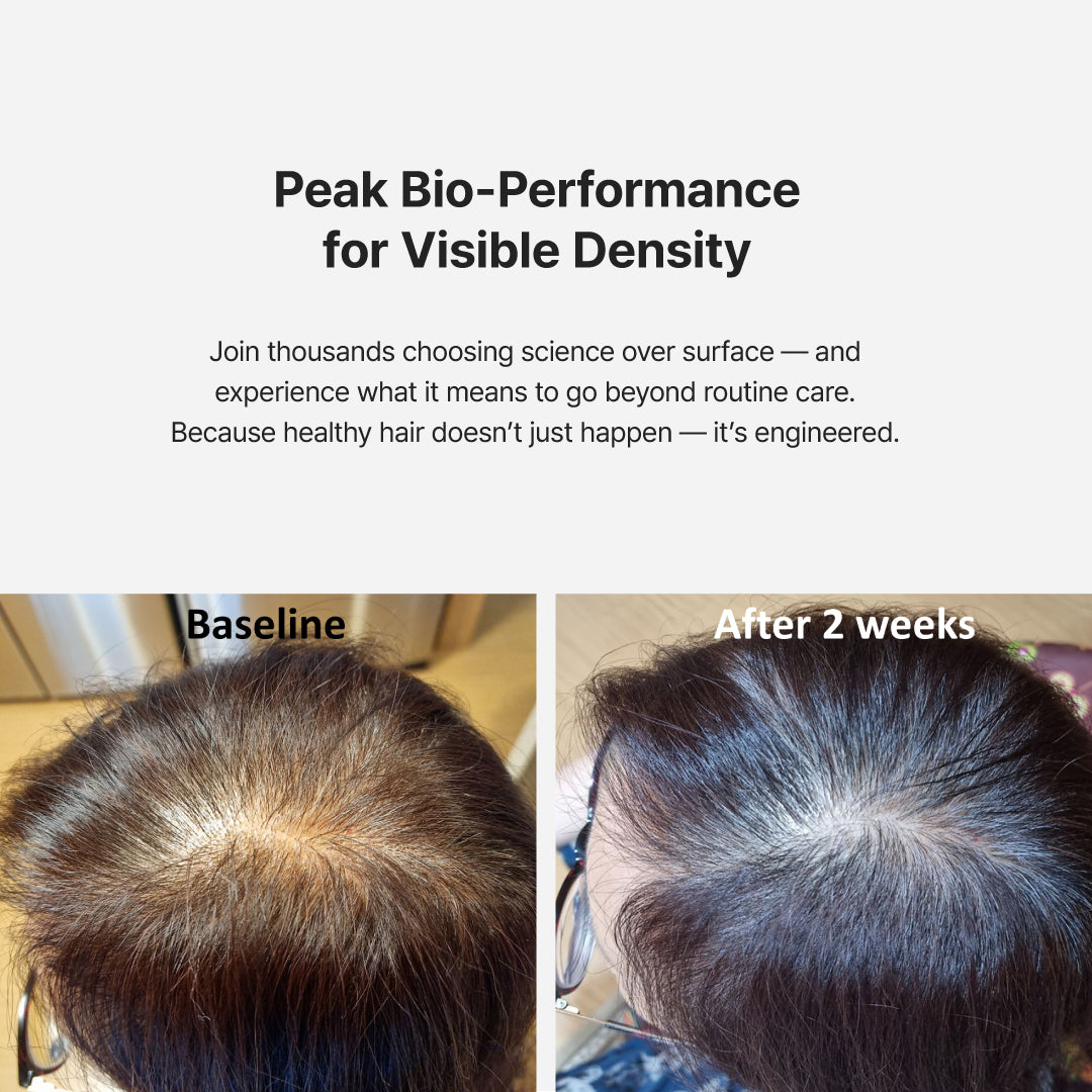 LIORA RÉVIA™ Advanced Follicle Activator - for a luxury skin aesthetic clinic